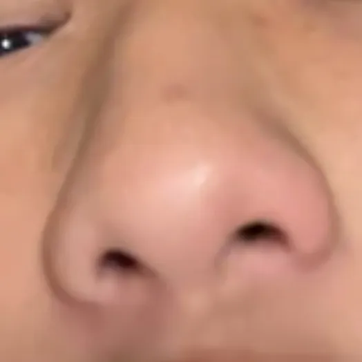 Ảnh 1 của mũi 
